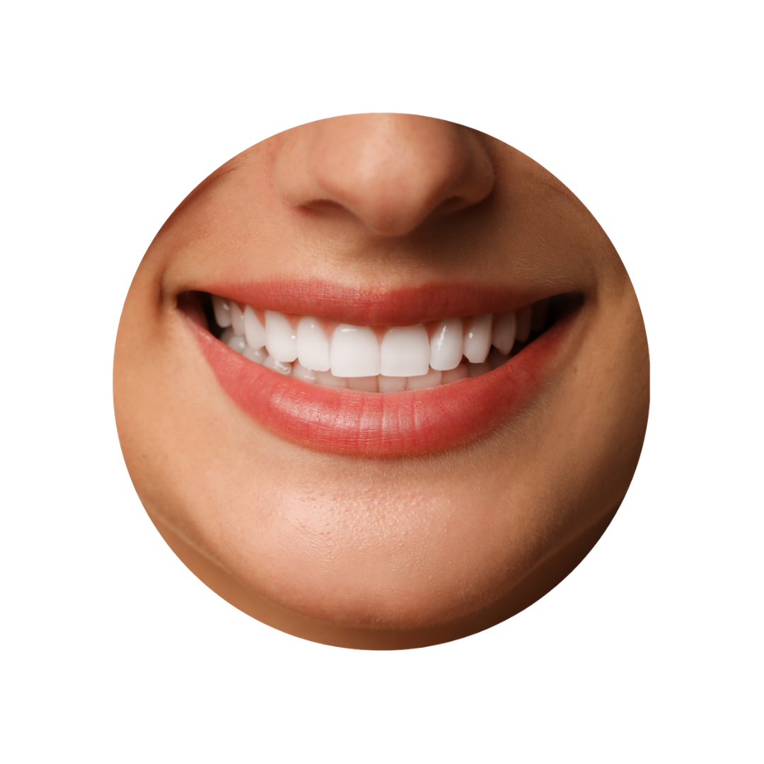 facetas e lentes de contato